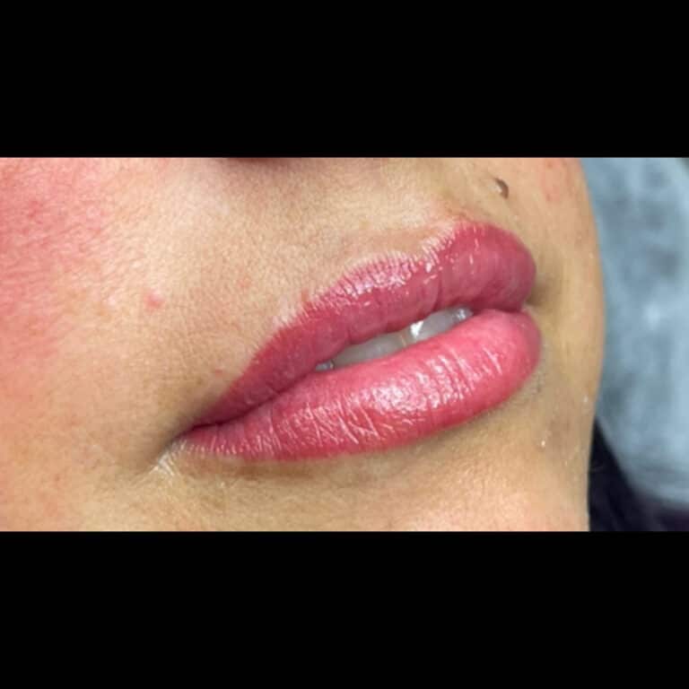 After Image: Lip Blushing - right-front-oblique